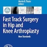 Fast Track Surgery in Hip and Knee Arthroplasty: New Standards