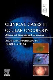 عکس Clinical Cases in Ocular Oncology: Differential Diagnosis and Management 1st Edition