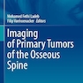 Imaging of Primary Tumors of the Osseous Spine