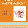 Cloacal Malformations: Case Studies (Pediatric Colorectal Surgery) 1st Edition