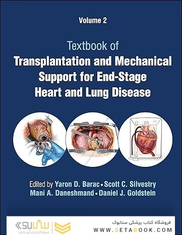 Transplantation and Mechanical Support for End-Stage Heart and Lung Disease