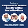 Transplantation and Mechanical Support for End-Stage Heart and Lung Disease