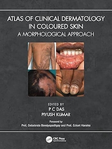 عکس Atlas of Clinical Dermatology in Coloured Skin: A Morphological Approach 1st Edition