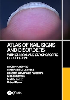 عکس Atlas of Nail Signs and Disorders with Clinical and Onychoscopic Correlation 1st Edition