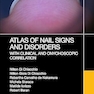 Atlas of Nail Signs and Disorders with Clinical and Onychoscopic Correlation 1st Edition