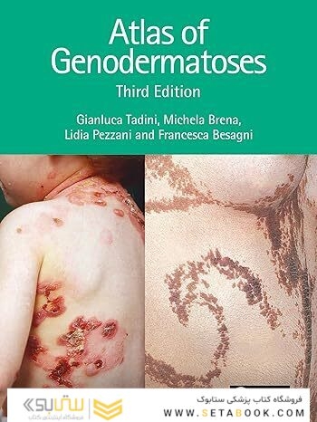 Atlas of Genodermatoses 3rd Edition