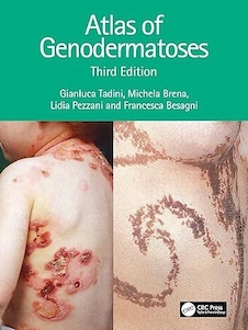عکس Atlas of Genodermatoses 3rd Edition
