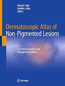 عکس Dermatoscopic Atlas of Non-Pigmented Lesions: Case-based Analysis and Management Options