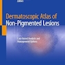 Dermatoscopic Atlas of Non-Pigmented Lesions: Case-based Analysis and Management Options