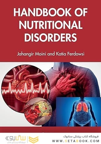 Handbook of Nutritional Disorders 1st Edition
