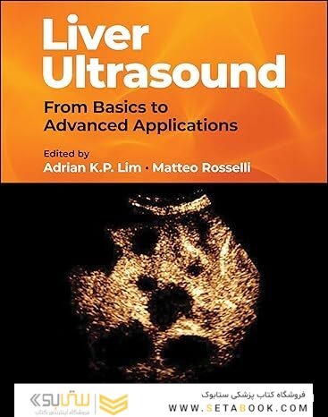 Liver Ultrasound: From Basics to Advanced Applications 1st Edition
