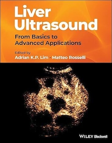 عکس Liver Ultrasound: From Basics to Advanced Applications 1st Edition