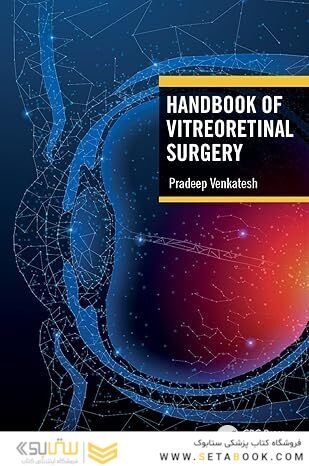 Handbook of Vitreoretinal Surgery 1st Edition
