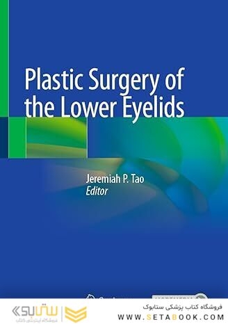 Plastic Surgery of the Lower Eyelids 1st ed