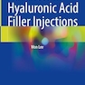 Advances in Hyaluronic Acid Filler Injections