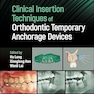 Clinical Insertion Techniques of Orthodontic Temporary Anchorage Devices 1st Edition