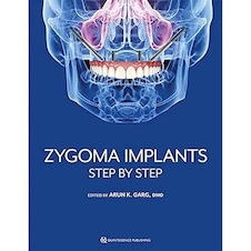 عکس Zygoma Implants: Step by Step 1st Edition