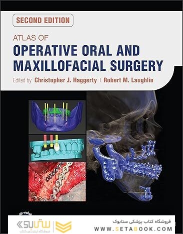 Atlas of Operative Oral and Maxillofacial Surgery 2nd Edition