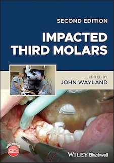 عکس Impacted Third Molars 2nd Edition