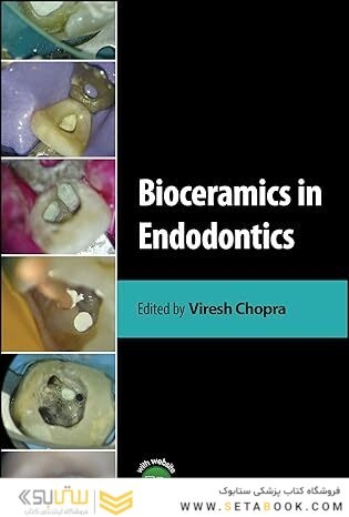 Bioceramics in Endodontics 1st Edition