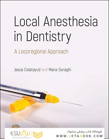 Local Anesthesia in Dentistry: A Locoregional Approach 1st Edition