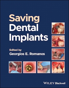 عکس Saving Dental Implants 1st Edition