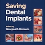 Saving Dental Implants 1st Edition