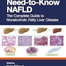 Need-to-Know NAFLD: The Complete Guide to Nonalcoholic Fatty Liver Disease 1st Edition