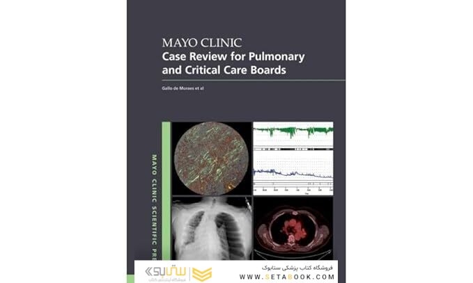 Mayo Clinic Case Review for Pulmonary and Critical Care Boards