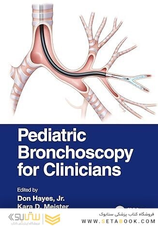 Pediatric Bronchoscopy for Clinicians 1st Edition