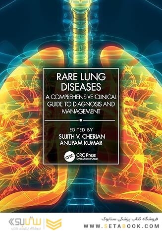 Rare Lung Diseases: A Comprehensive Clinical Guide to Diagnosis and Management