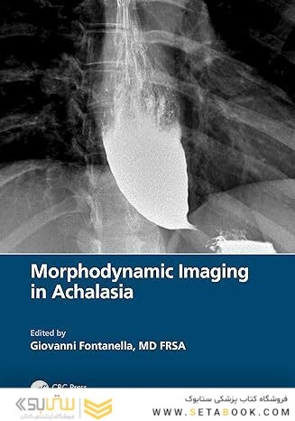Morphodynamic Imaging in Achalasia 1st Edition