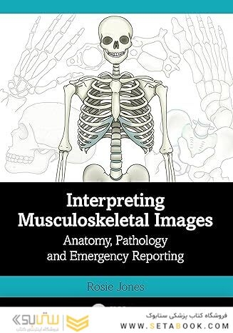 Interpreting Musculoskeletal Images: Anatomy, Pathology and Emergency Reporting 1st Edition