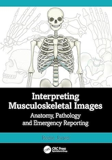 عکس Interpreting Musculoskeletal Images: Anatomy, Pathology and Emergency Reporting 1st Edition