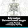 Interpreting Musculoskeletal Images: Anatomy, Pathology and Emergency Reporting 1st Edition