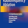Thyroid Radiofrequency Ablation: A Comprehensive Guide