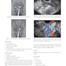 Algorithms in Infertility and Reproductive Medicine