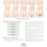 Algorithms in Infertility and Reproductive Medicine