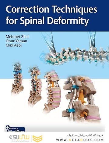 Correction Techniques for Spinal Deformity