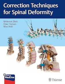 عکس Correction Techniques for Spinal Deformity