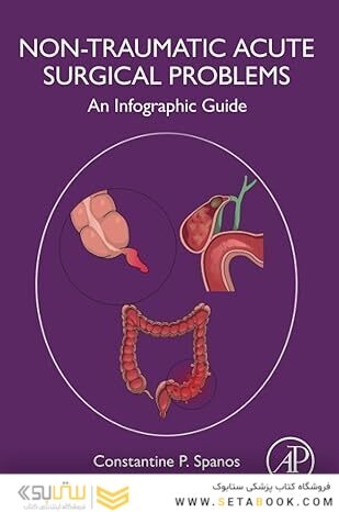 Non-Traumatic Acute Surgical Problems: An Infographic Guide 1st Edition