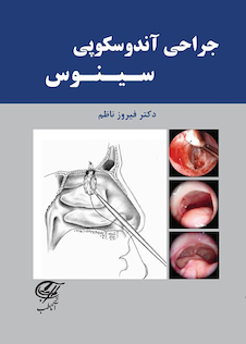 عکس جراحی آندوسکوپی سینوس