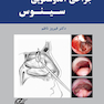 جراحی آندوسکوپی سینوس