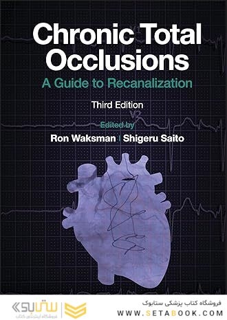 Chronic Total Occlusions: A Guide to Recanalization 3rd Edition