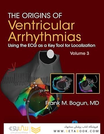 The Origins of Ventricular Arrhythmias: Using the ECG as a Key Tool for Localization, Volume 3