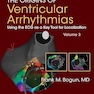 The Origins of Ventricular Arrhythmias: Using the ECG as a Key Tool for Localization, Volume 3