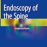 Endoscopy of the Spine: Principle and Practice 1st ed