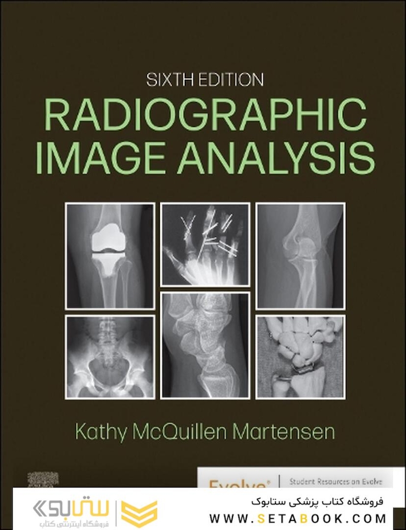 Radiographic Image Analysis 6th Edition