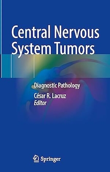 عکس Central Nervous System Tumors: Diagnostic Pathology