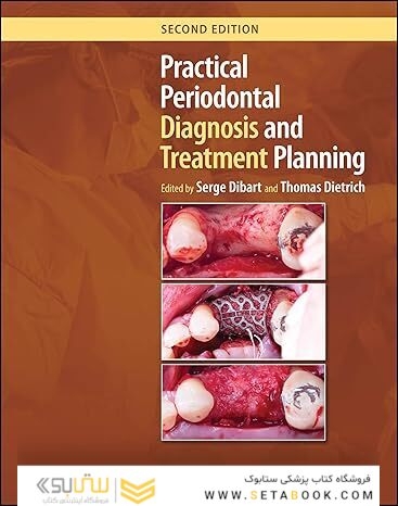 Practical Periodontal Diagnosis and Treatment Planning
